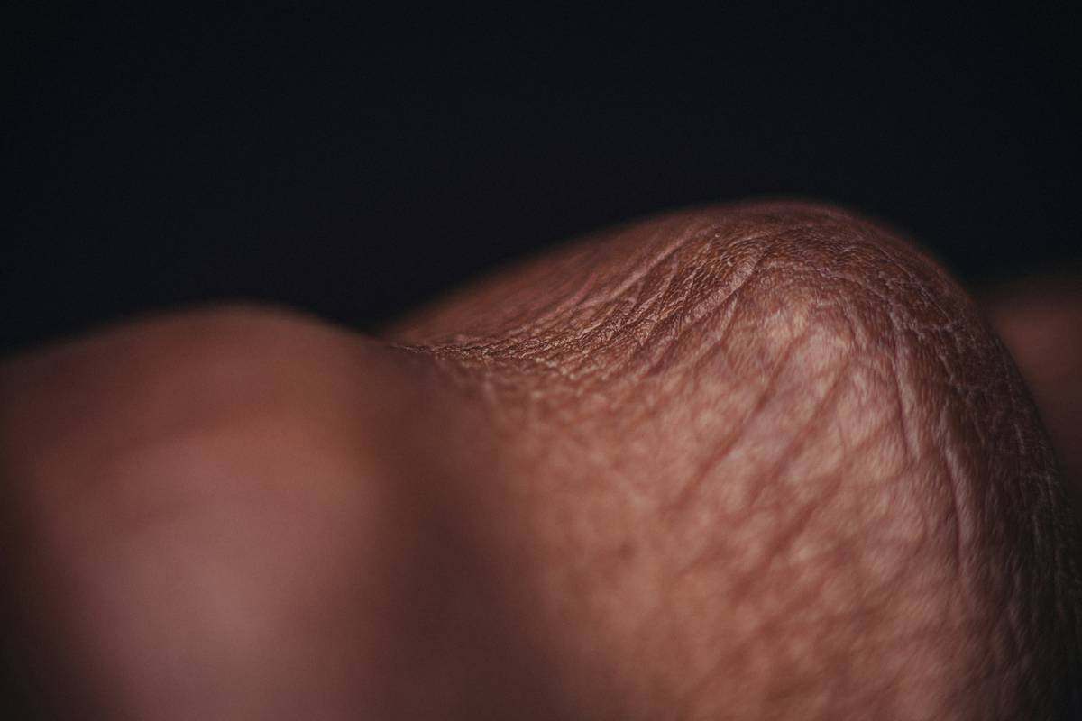 what is glycolic acid for skin: close-up of smooth, glowing skin after glycolic acid peel treatment